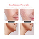 massagem facial Led Aparelho Tratamento Com Luz (Cor Sortida)