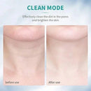 massagem facial Led Aparelho Tratamento Com Luz (Cor Sortida)